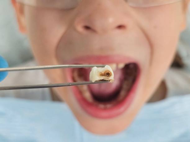 Best Emergency Broken Tooth Repair in Meadowood, PA