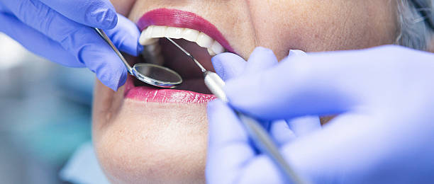 Best Emergency Broken Tooth Repair in Meadowood, PA